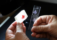 Promueve IMSS Veracruz Sur autoexploraciónpara detección oportuna de enfermedades Promueve IMSS Veracruz Sur autoexploraciónpara detección oportuna de enfermedades